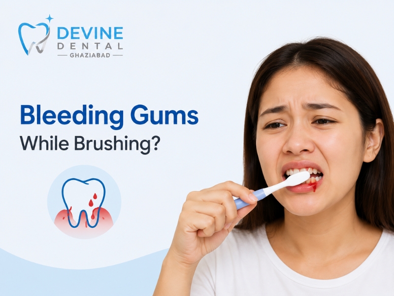 Bleeding Gums While Brushing? Here’s What Your Mouth Is Trying to Tell You | Devine Dental, Ghaziabad