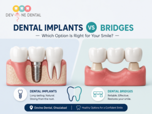 Dental Implants vs Bridges