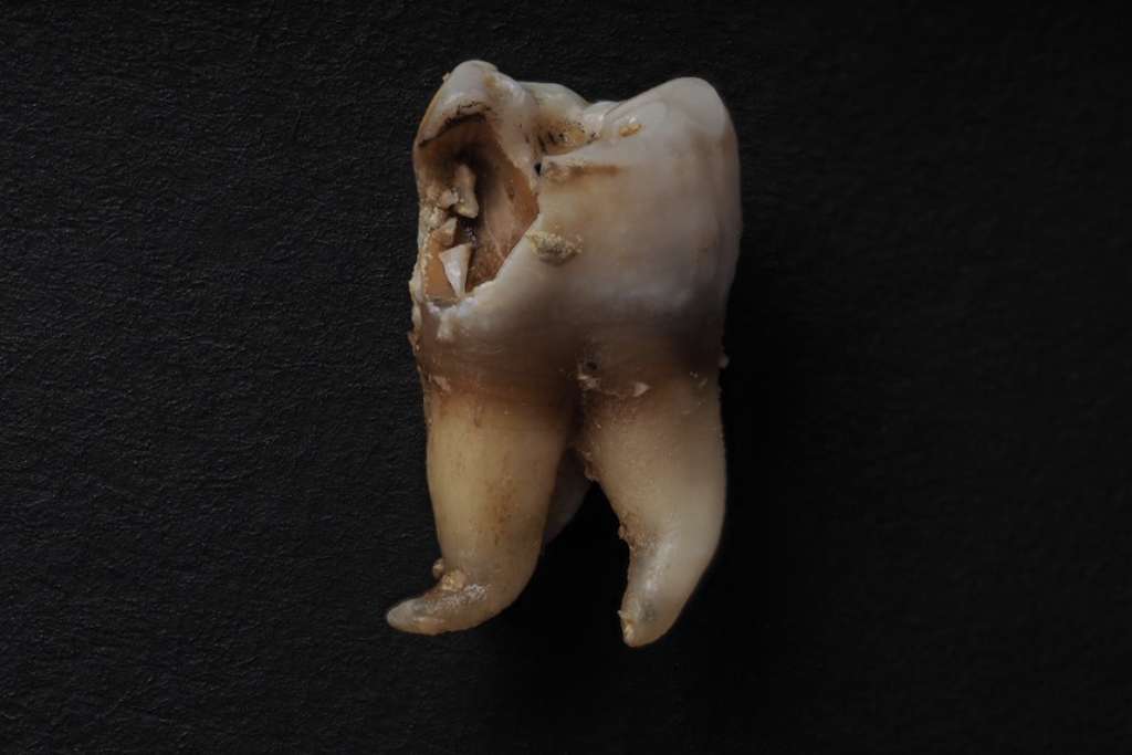 Decay