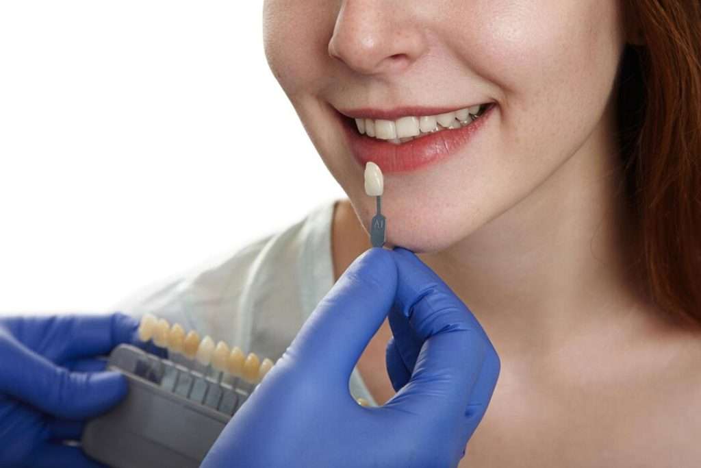 Dental-Veneers-thumb