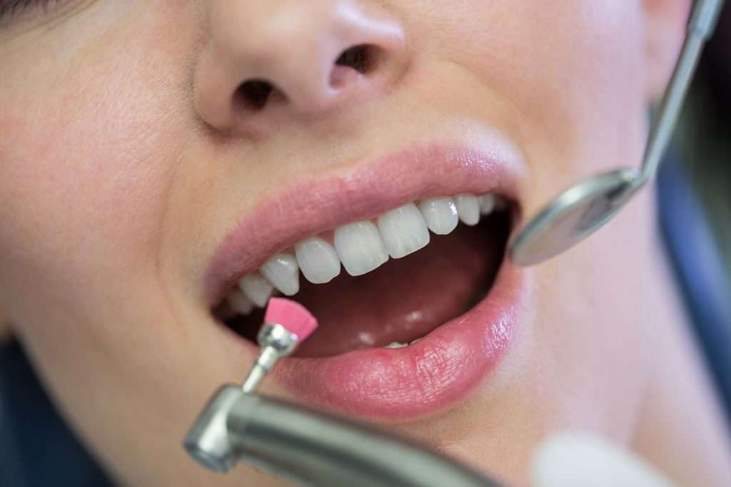 Fluoride-thumb
