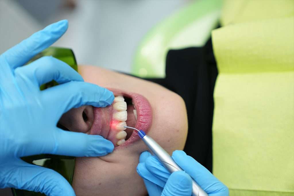 Laser-periodontal