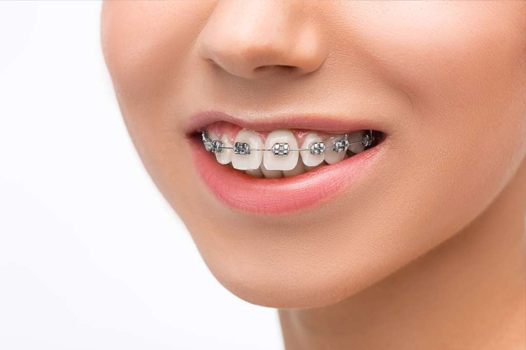 Orthodontic-Considerations