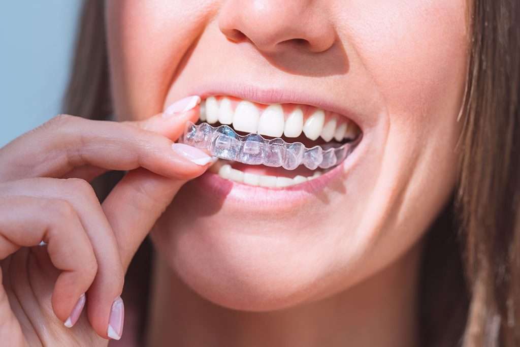 Orthodontics-thumb