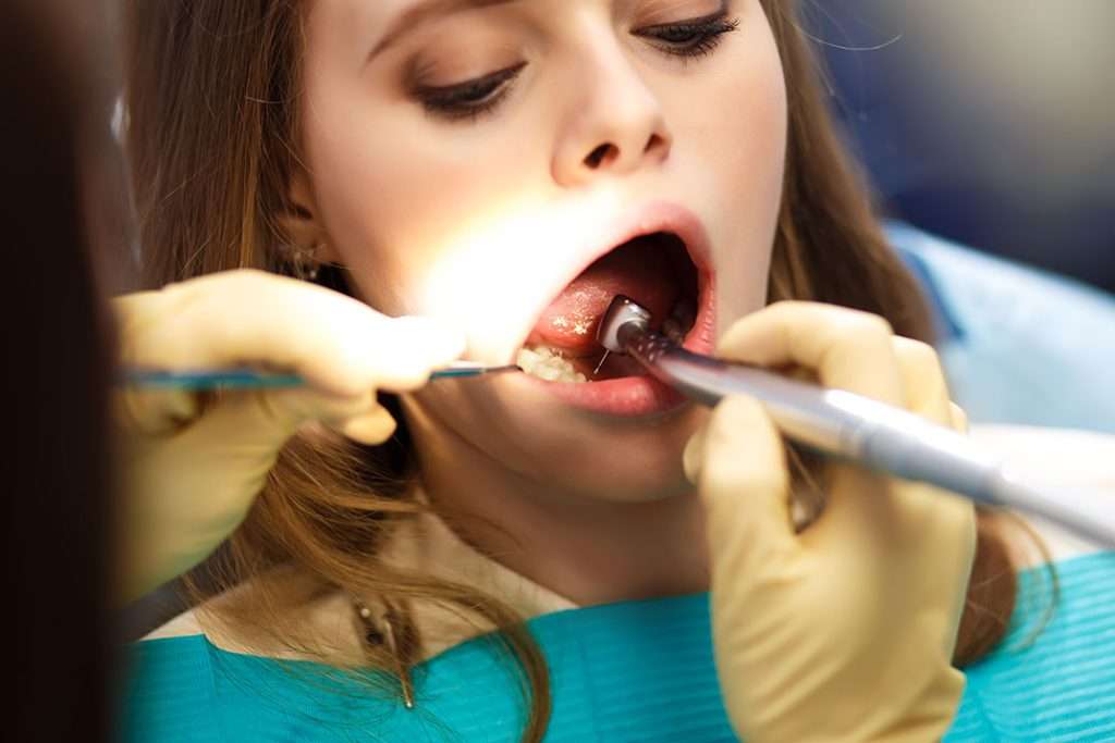 Restore-tooth