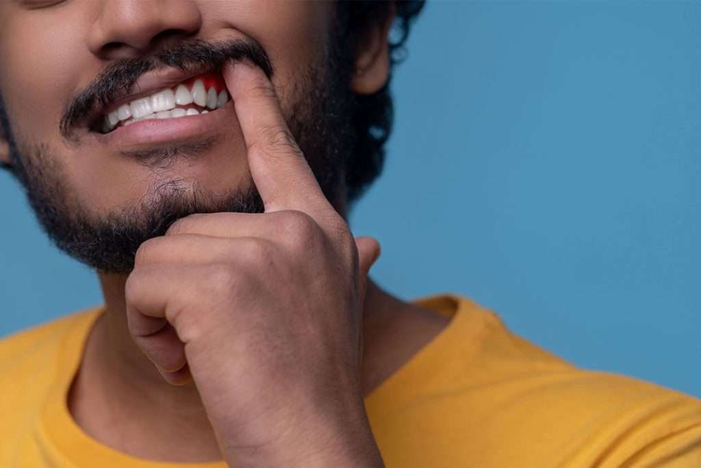 Teeth-Loss