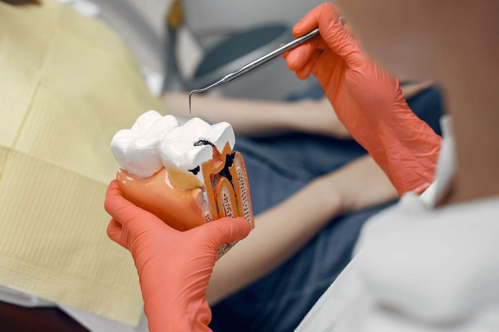 root-canal