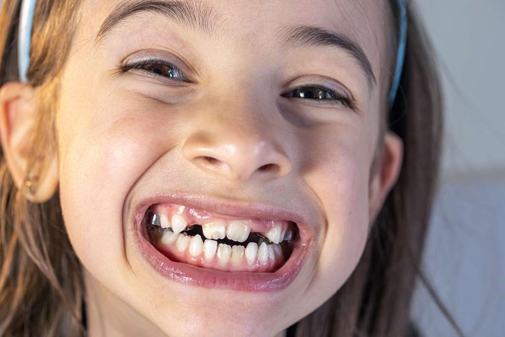 Pediatric Dentistry